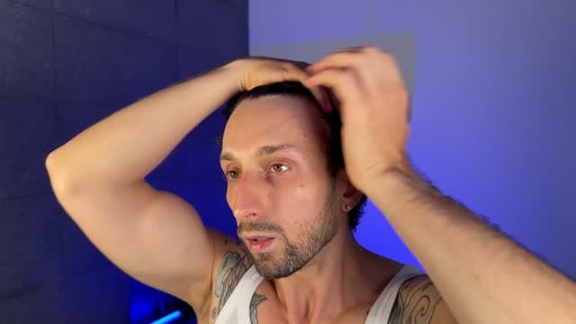 Forehead